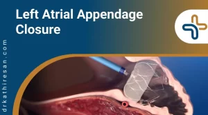 Left Atrial Appendage Closure