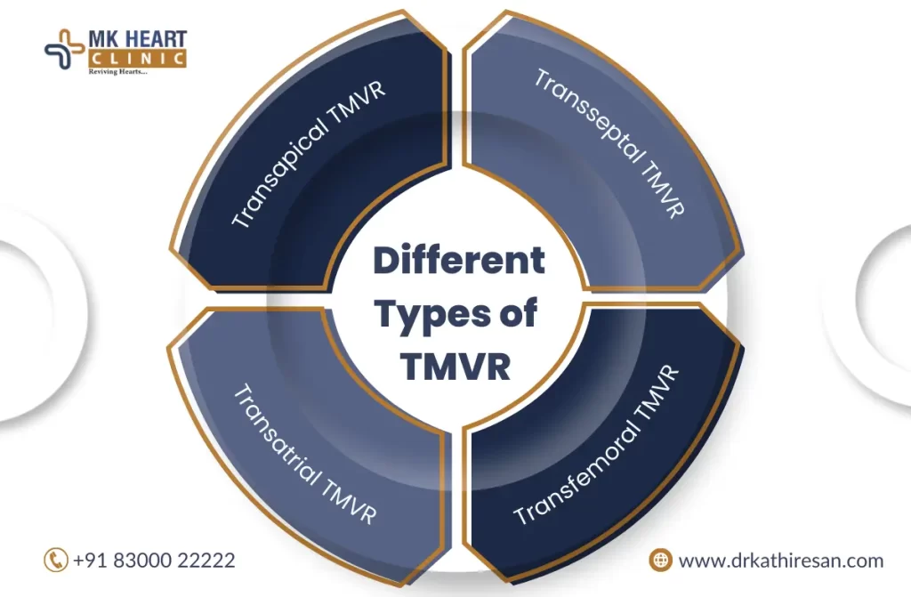 Transcatheter Tricuspid Valve Replacement in chennai | Dr. M. Kathiresan