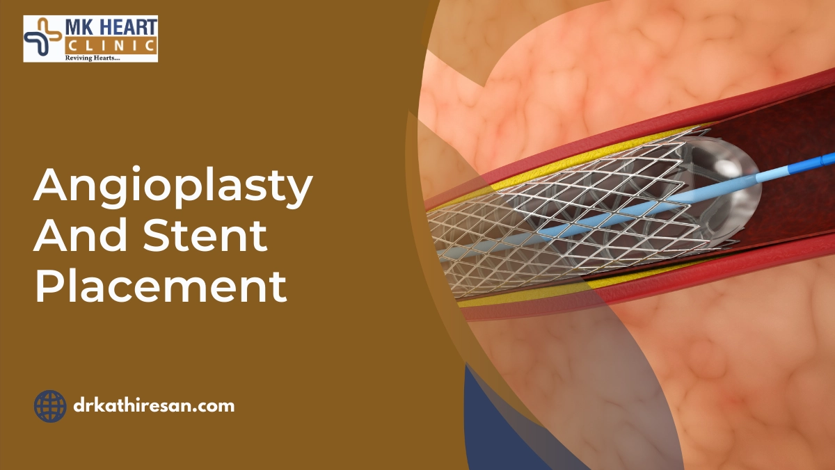 Angioplasty And Stent Placement